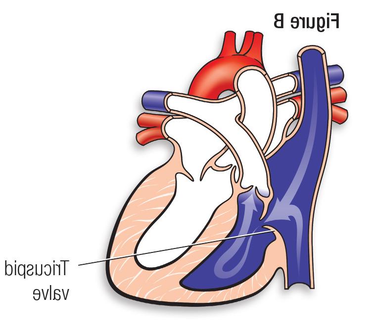 正常心脏图B