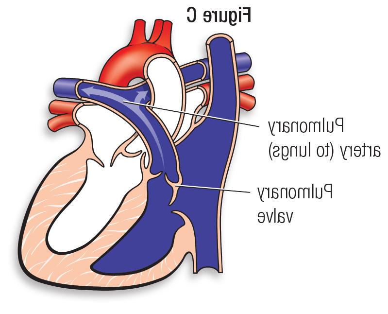 正常心脏图C