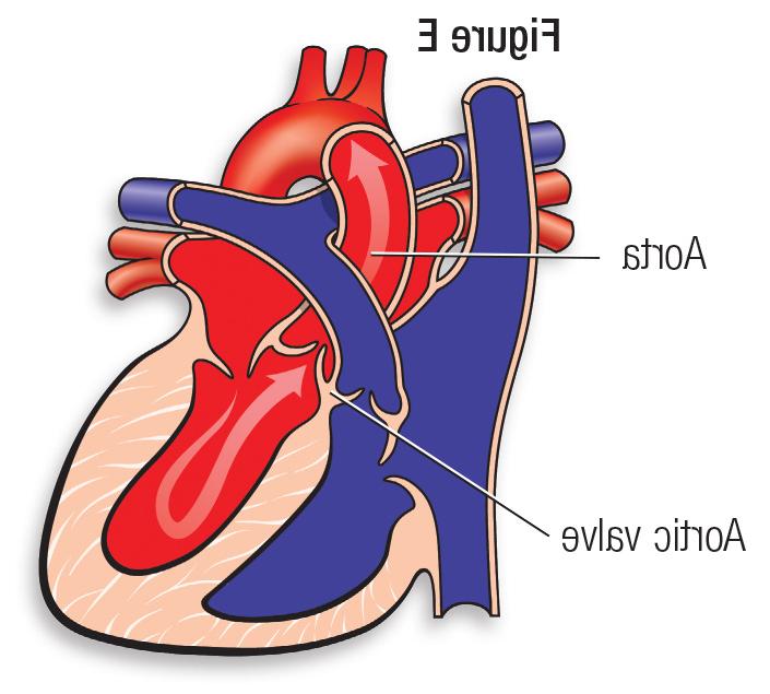 正常心脏图E